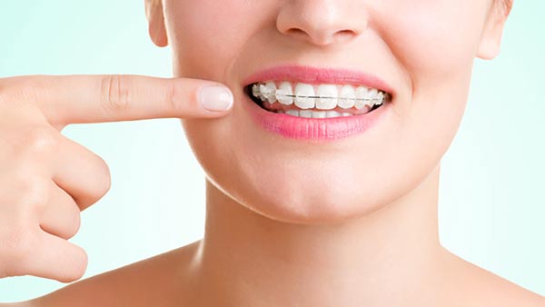 Ceramic braces treatment in chandigarh